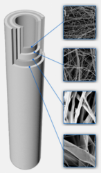 10" 5µm vícevrstvý sedimentační filtr MIN